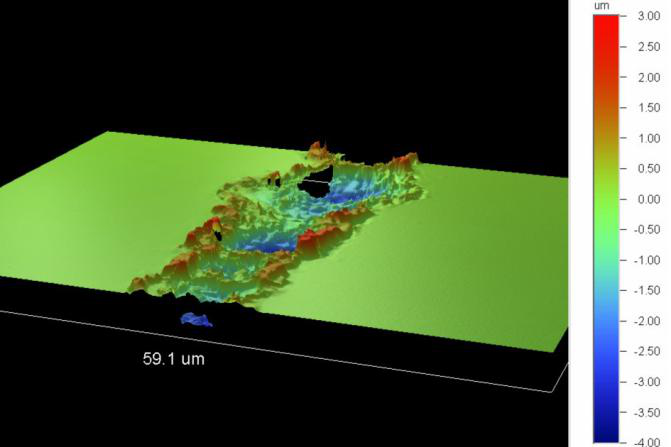 LASEROVÉ VRTÁNÍ MICROVIA (4)