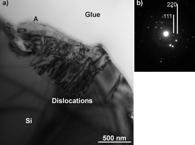 LASEROVÉ VRTÁNÍ MICROVIA (12)