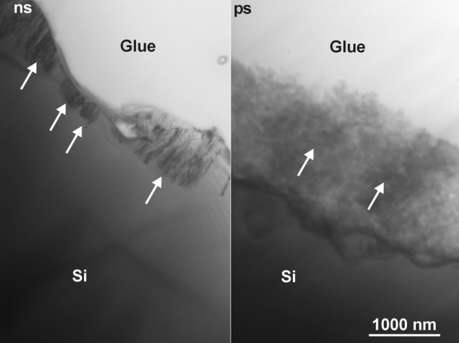 LASEROVÉ VRTÁNÍ MICROVIA (11)