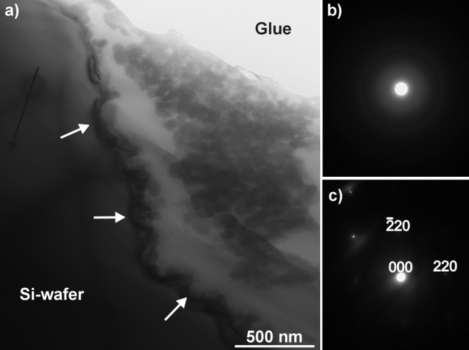 LASEROVÉ VRTÁNÍ MICROVIA (15)