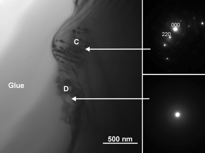 LASEROVÉ VRTÁNÍ MICROVIA (14)